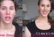 cacher-ses-boutons-grace-au-maquillage tuto