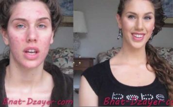 cacher-ses-boutons-grace-au-maquillage tuto