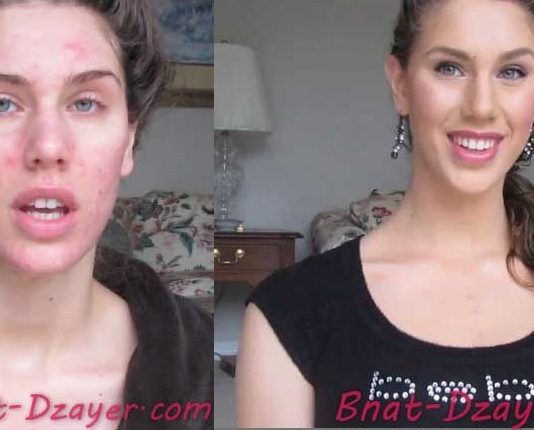 cacher-ses-boutons-grace-au-maquillage tuto