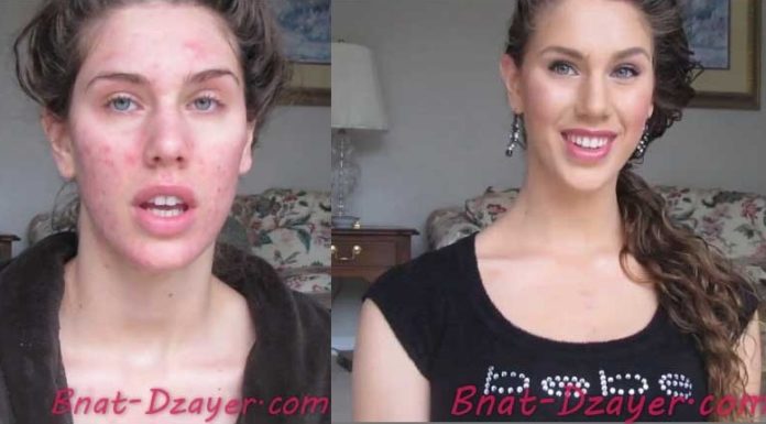 cacher-ses-boutons-grace-au-maquillage tuto